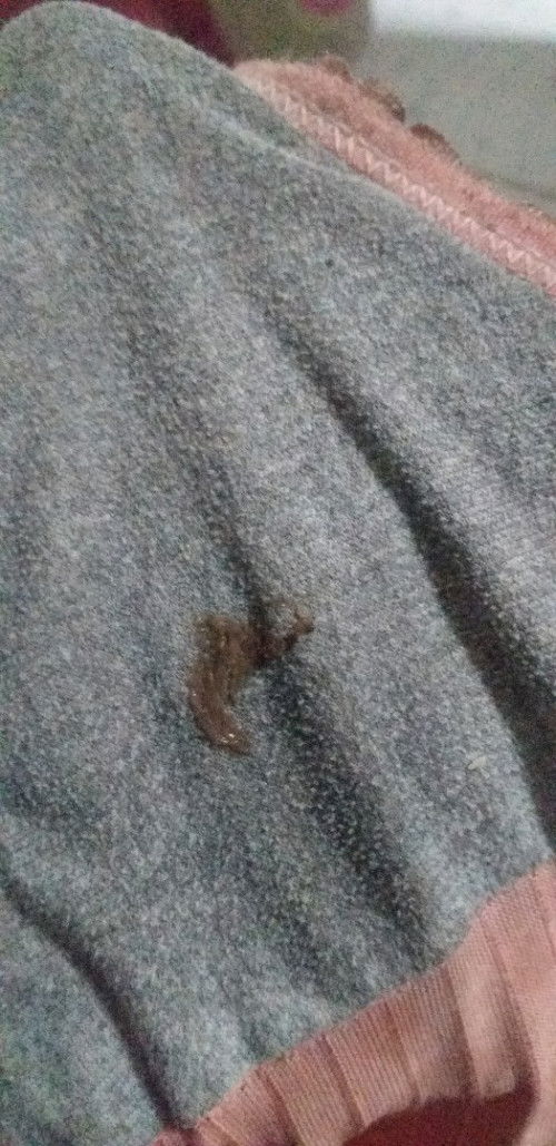 ท้องได้ 33 week 2 วัน ท้องแรก