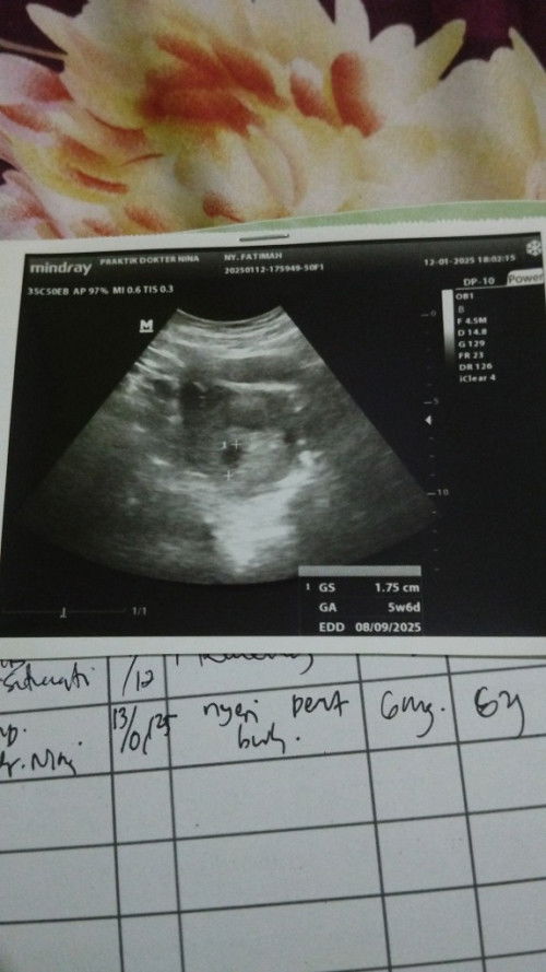 Aku hpht 7 november, chek ke RS tgl 16-12-24 usia janin 5w2d. Ketika tgl 12-01-25 usia janin 5w6d