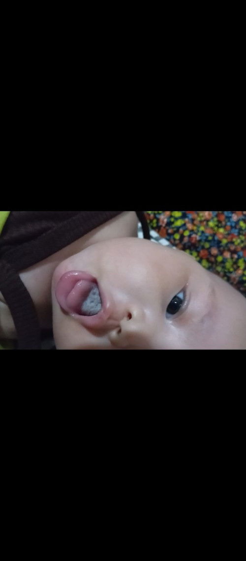 Lidah bayi berwarna putih