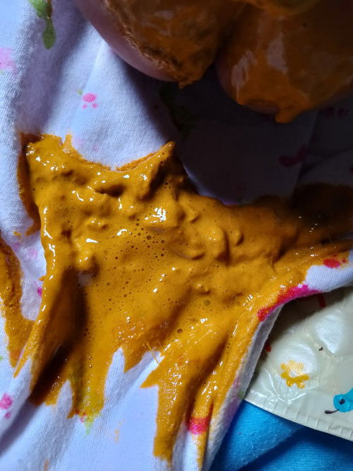 ลูกถ่ายเป็นฟอง