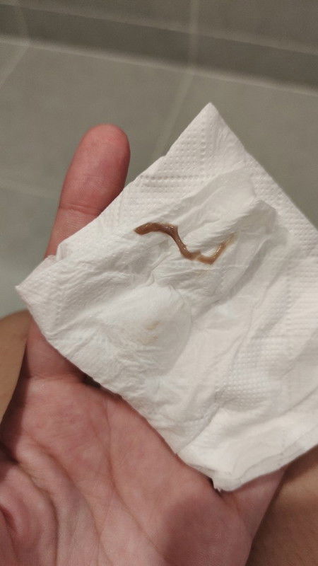 มีแม่ๆคนไหนเป็นตกขาวสีน้ำตาลแบบนี้ไหมค่ะ