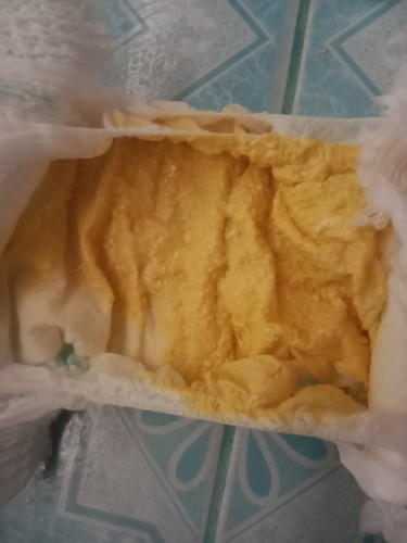 สีอุจจาระทารก