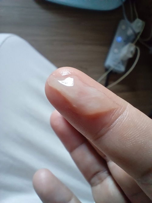 มีมูกใส ตั้งครรภ์ 38 + 3 w  อีกนานไหมกว่าจะคลอด