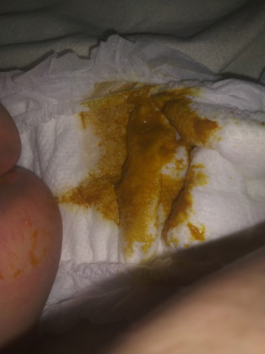 Formula Feed Poop