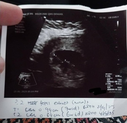 Baby twin 6 week