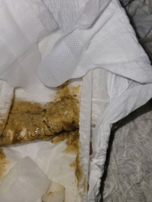 Normal kaya kulay ng tae ni baby 2 months old?