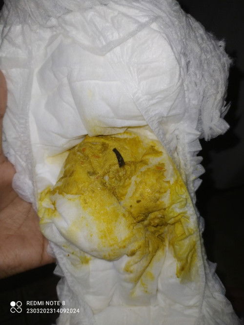 MAAF BARANGKALI JIJI BUN

Usia 20 bulan
Kemarin anaku bab seperti itu 6x termasuk diare bukan Bun???