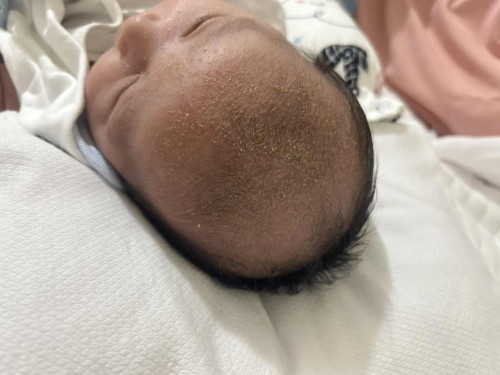 Newborn Baby