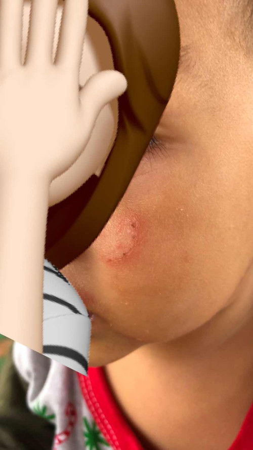 สอบถามแม่ๆค่ะ