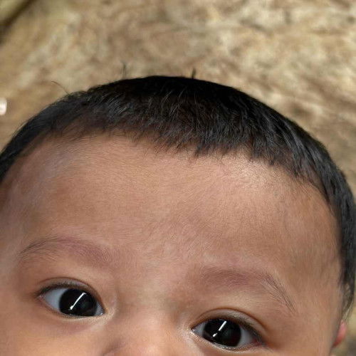 bintik putih pada bayi