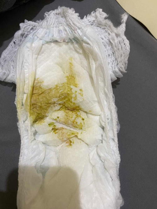 Pup bayi 2 bulan full ASI