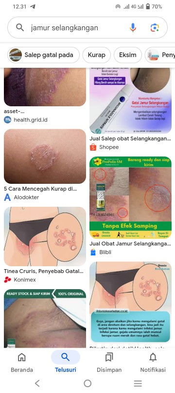 Bunda2 mau nanya selangkangan gatel bgt bahkan sama persis kaya di foto,itu pake apa ya bun