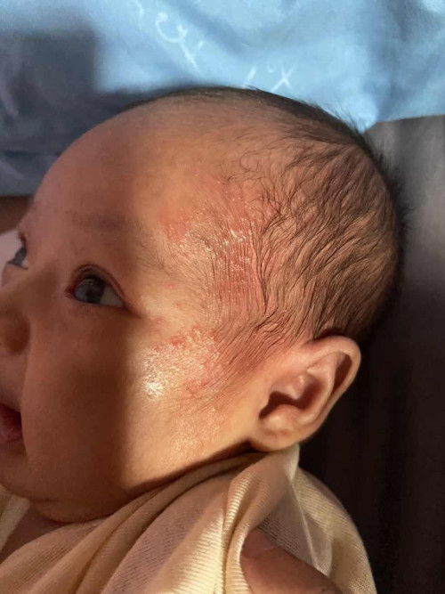 Ini biang keringat atau apa ya bun