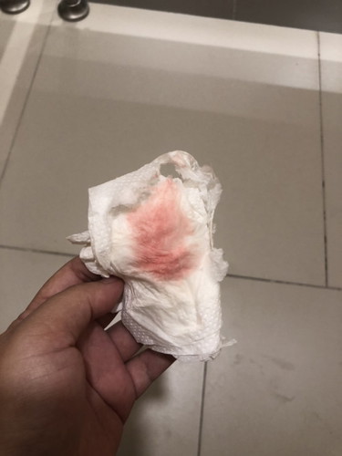 Ada darah keluar warna merah cair