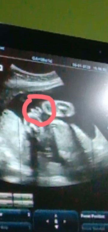 Menurut bunda2 ini jk nya cwe or cwo