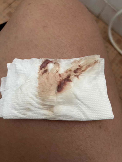 โดนกระตุ้นปากมดลูก