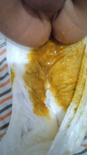 Bab 2 kali tapi cair kayak gini