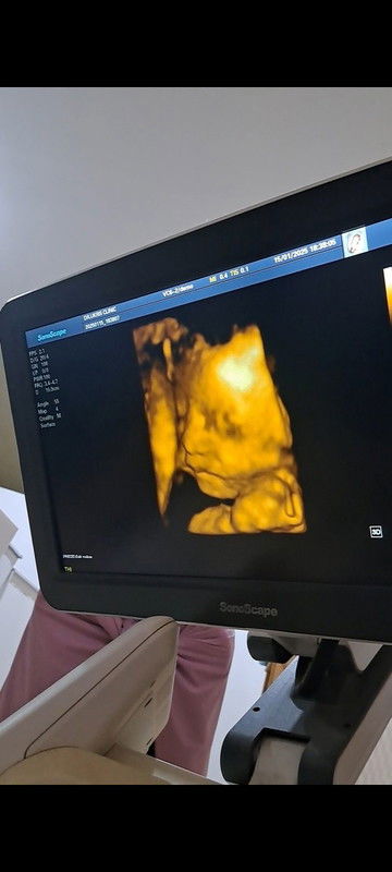 29+5วีค วันนี้ที่รอคอย