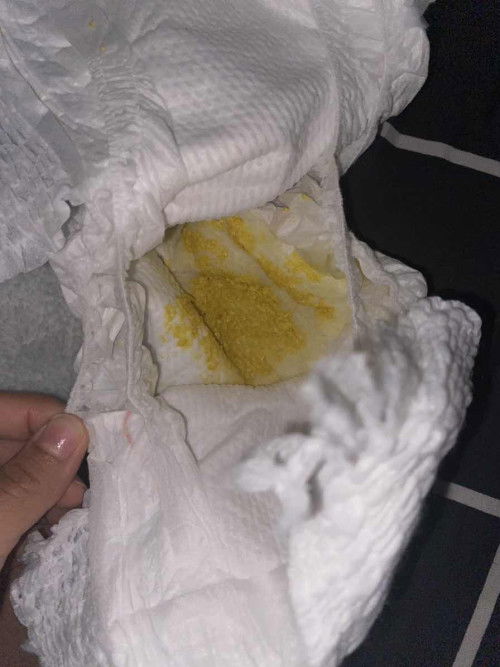 อาการท้องเสีย