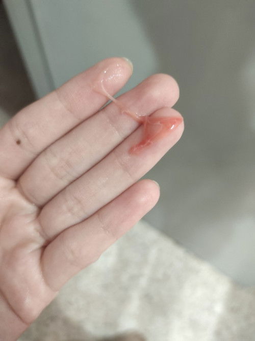 Lendir darah merah pink