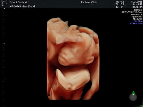 ปรึกษาแม่ๆหน่อยค่ะจะรับมือยังไงดี