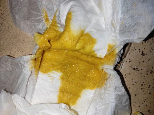 Pup bayi kadang encer