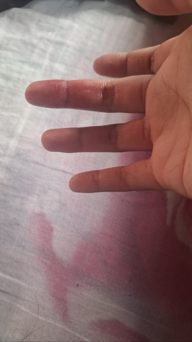 มีเลือดออกตอน 6 weeks