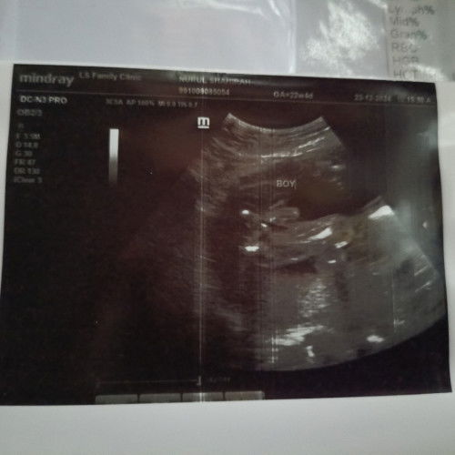 Detail scan masa 23 week