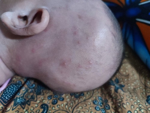Baby 1,5 bulan