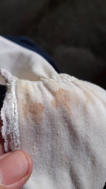 Keluar flek coklat diusia 28week