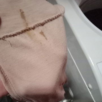 keluar flek cokelat sedikit