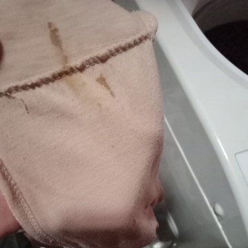 keluar flek cokelat sedikit