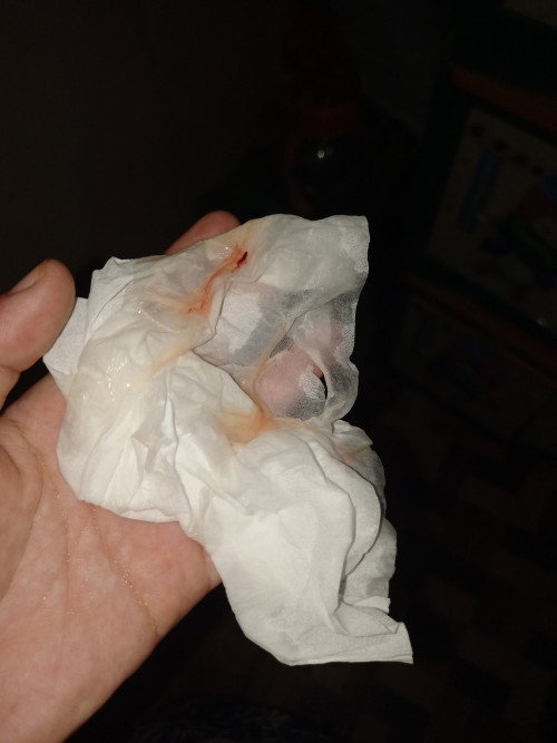 Hamil 37 week 2days Keluar Lendir campur Darah p