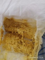 Assalamualaikum izin bertanya bunda