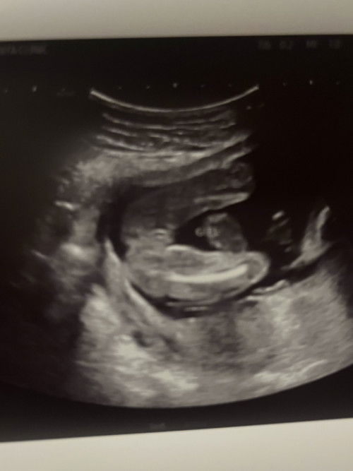 สอบถามแม่ๆหน่อยค่ะ แบบนี้ผญ.ชัวไหมค่ะ