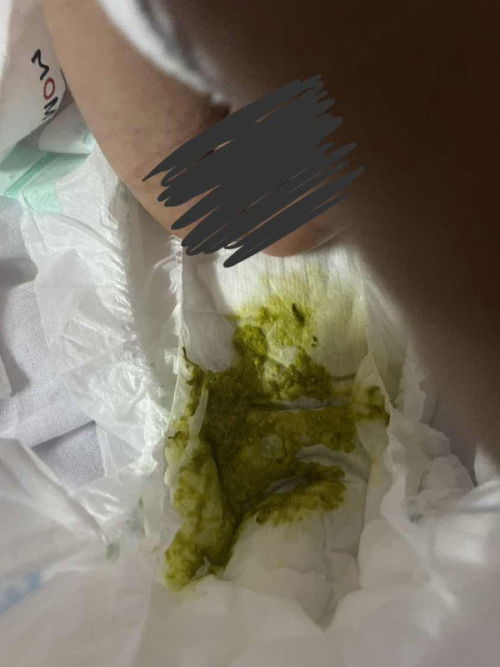 ลูกอึสีเขียวแบบนี่ปกติไหมคะ