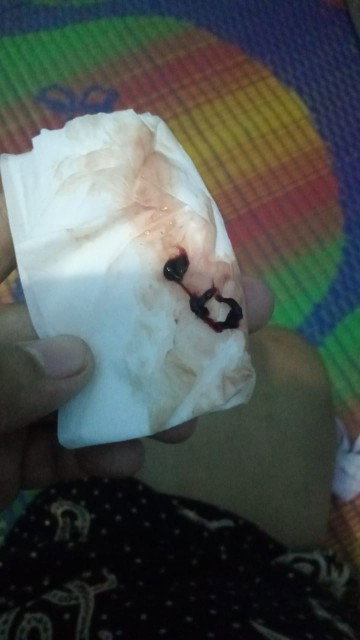 mau nanya, hplku hari ini 18 januari tadi jam 9 keluar lendir darah kaya gitu