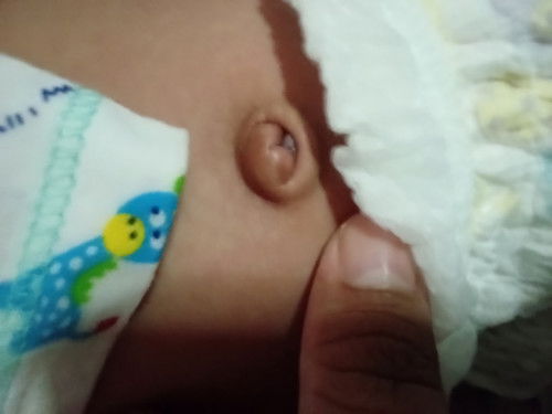 สอบถามแม่ๆเรื่องสะดือลูกหน่อยค่ะ