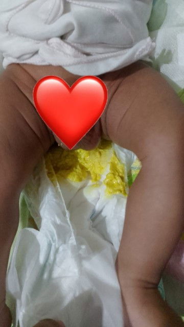 PUP SIKECIL KAYA GINI WAJAR GA BUND!!?