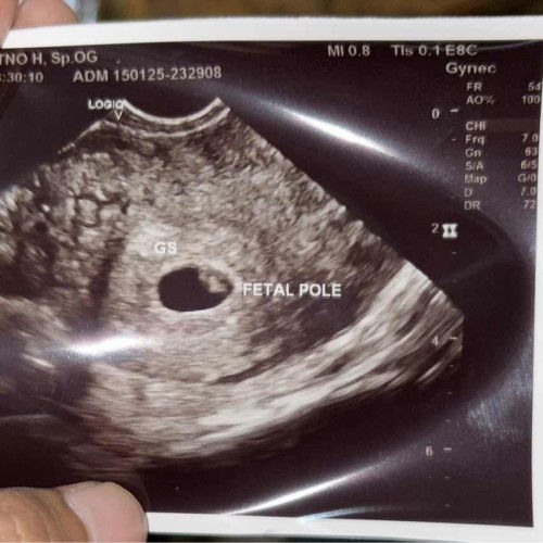 Hpht 22 november 2024