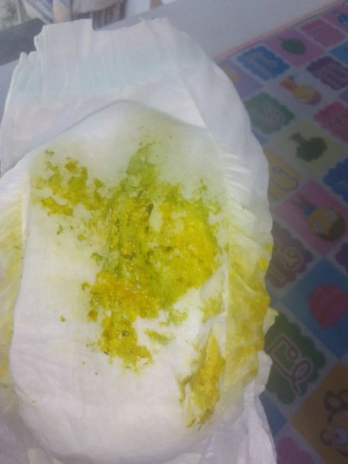 สีอึปกติหรือผิดปกติ