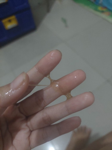Bun hamil 13week,flek prtma lendir kecoklatan muda,trs selang bbrpa hri flek darah seger,ada yg sma?