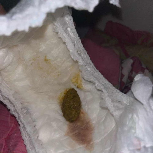 Pup sembelit dan ada lendir warna pink