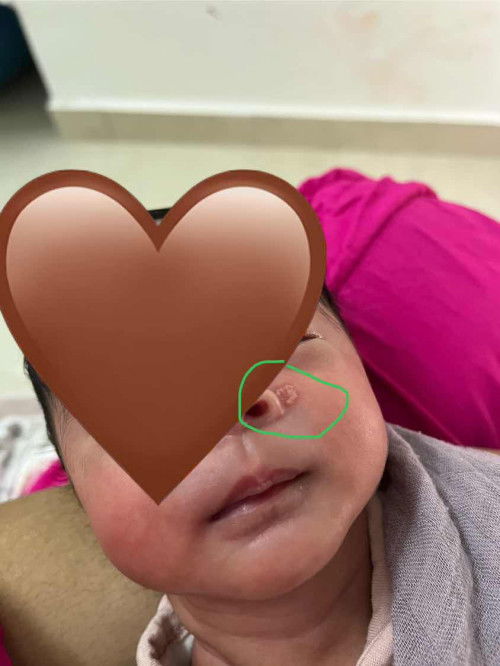 Help mummy with rashes