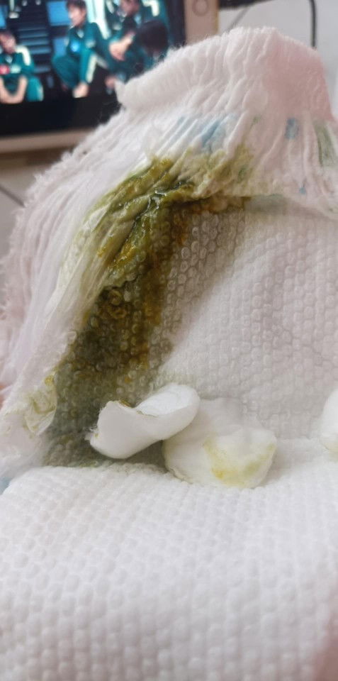 ลูกอึเขียว