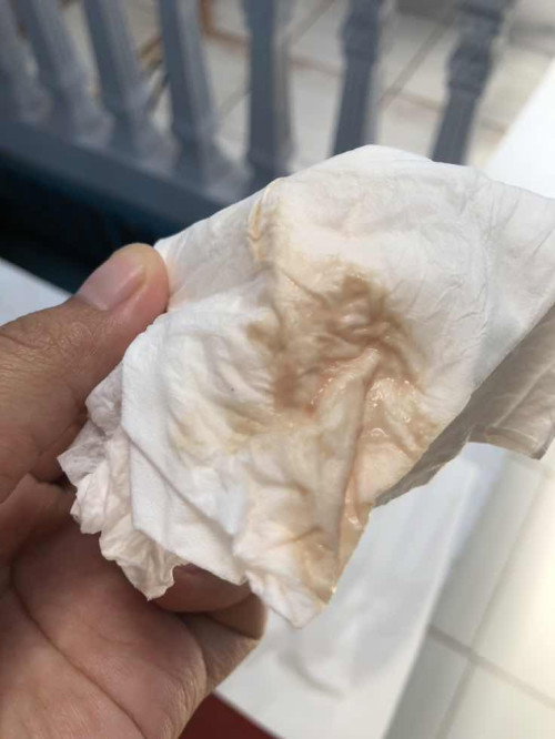 Usia kandungan menuju 39week