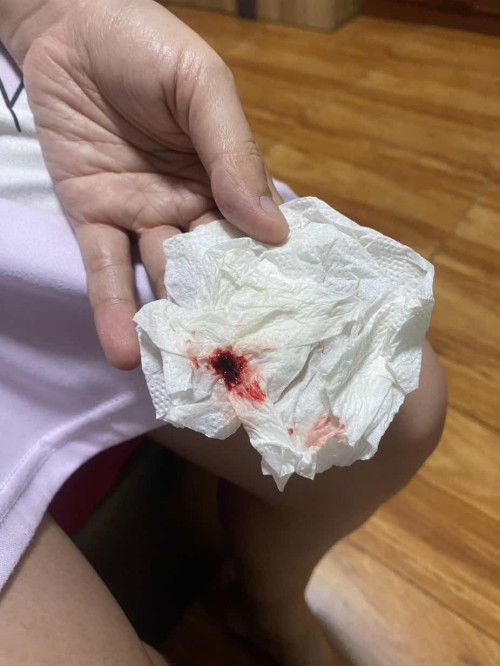 ท้อง3เดือน ภาวะแท้งคุกคาม