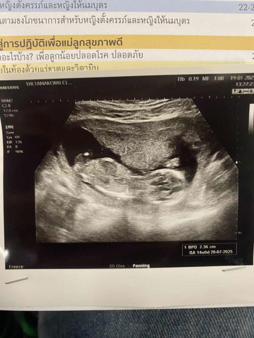 อ่านค่าใบซาวด์