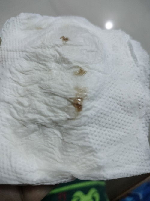 สอบถามแม่ๆค่ะ