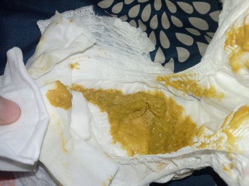 ลักษณะอึลูก